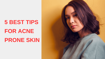 5 Best Tips for Acne Prone Skin