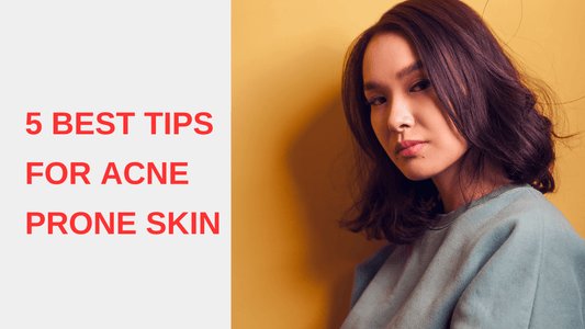 5 Best Tips for Acne Prone Skin